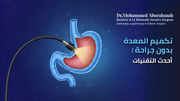 مخاطر عملية تكميم المعدة التي يجب أن تعرفها