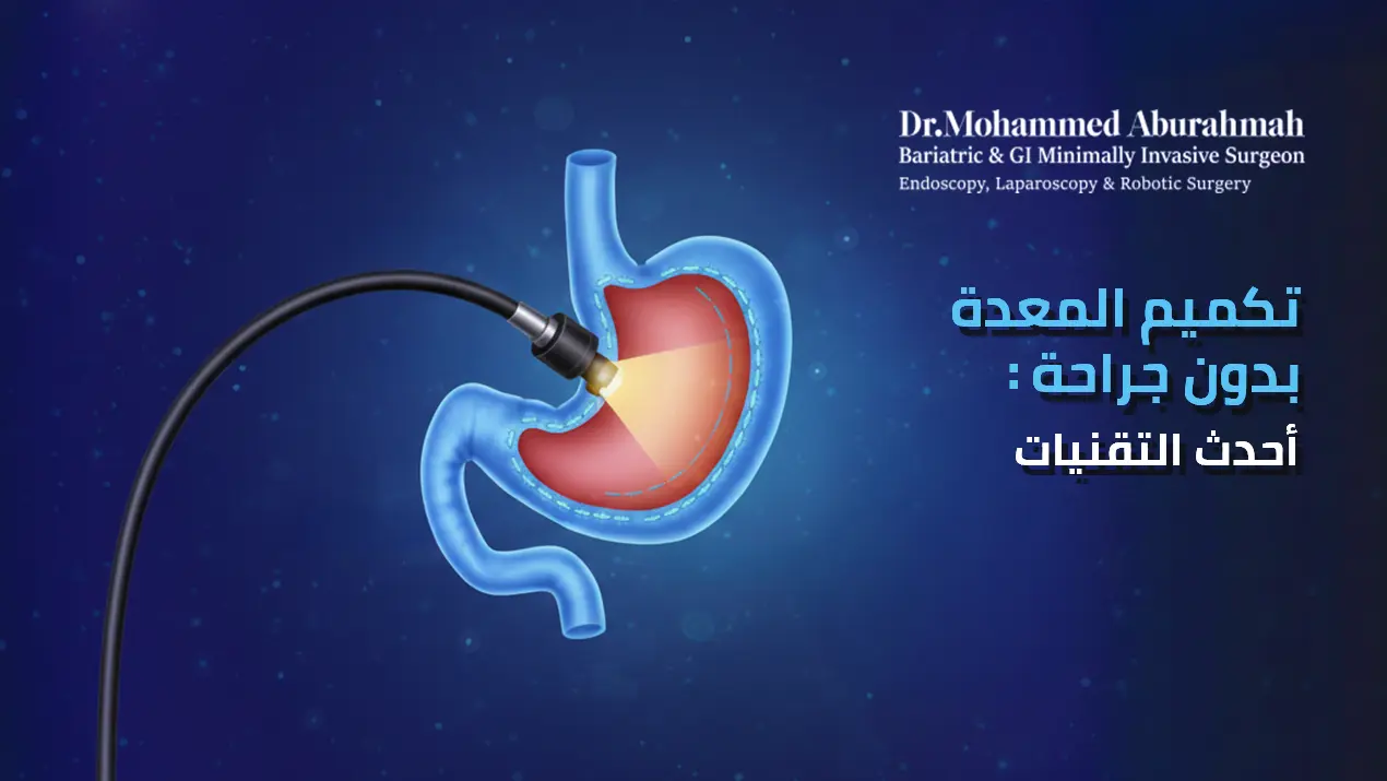 مخاطر عملية تكميم المعدة التي يجب أن تعرفها