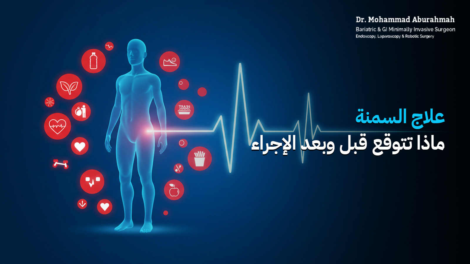 علاج السمنة