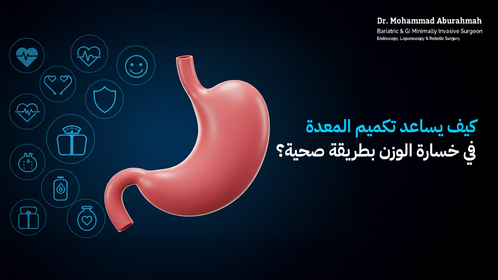 عملية تكميم المعدة